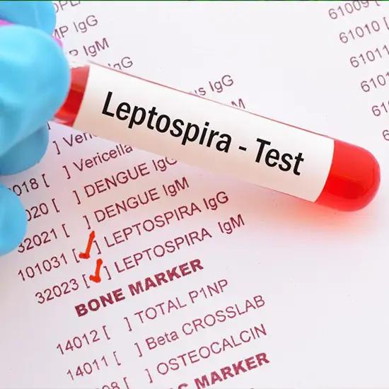 Leptospirosis Detection Test